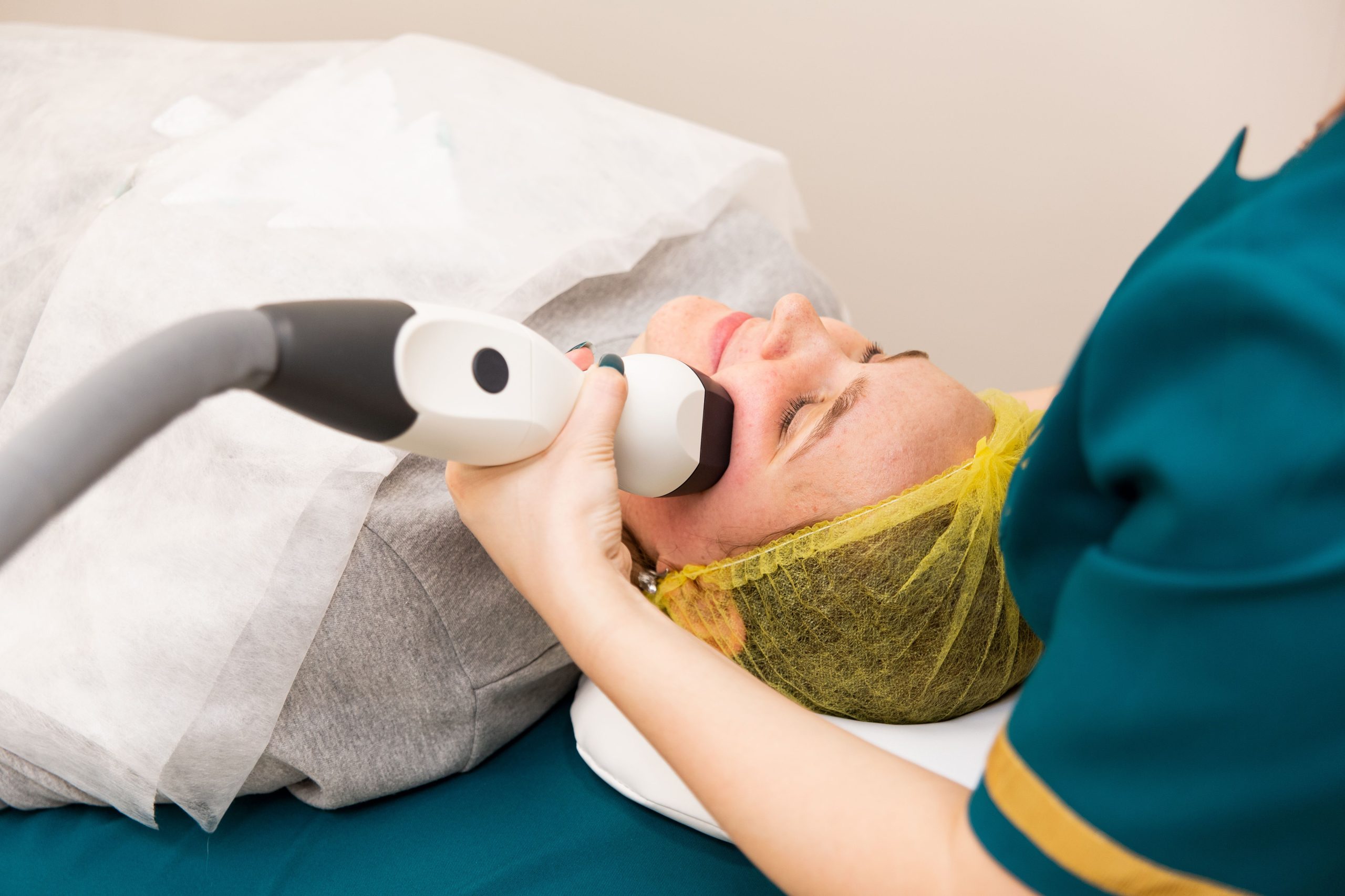 Laser dermatologique taches solaires visage et mains