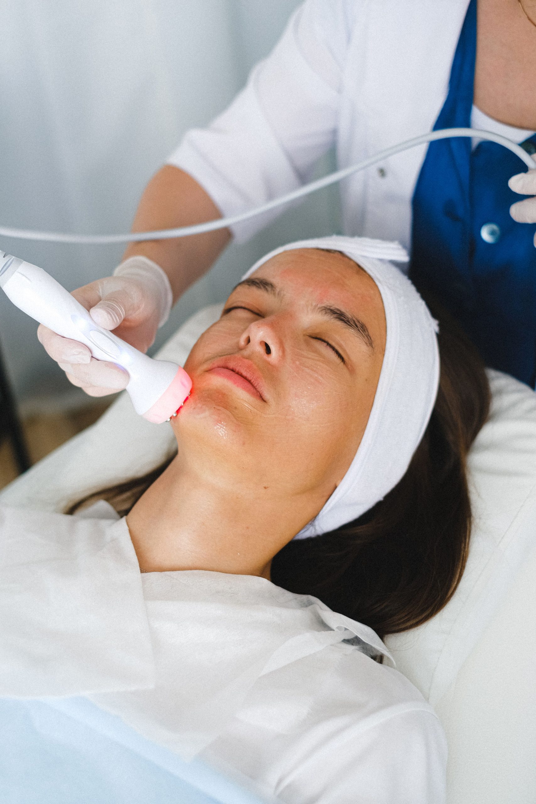 Laser vasculaire couperose érythrose angiomes visage